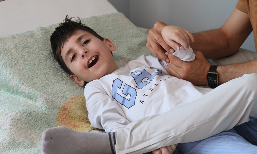 Milyonda bir görülüyor! Sivrisinek ısırığı hayatını kararttı - Resim : 2