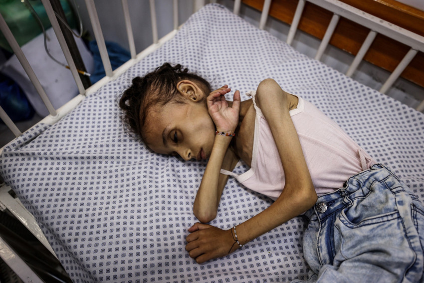 Gazze'de açlık yavaş yavaş öldürüyor!  9 yaşındaki Meryem 10 kiloya düştü! 'Bu benim kızım mı?' - Resim : 5