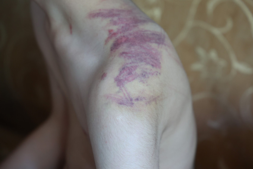 Rehabilitasyon merkezinde kan donduran olay! Down sendromlu çocuğa şiddet: Soruşturma başlatıldı - Resim : 2