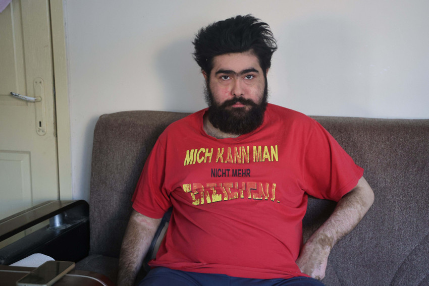 Depremden sonra hayattan koptu! 3 aylık tedavi de yetmedi: Ben artık iflah olmam - Resim : 1