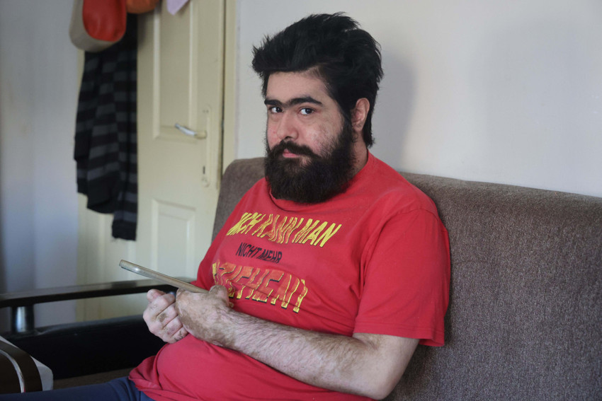 Depremden sonra hayattan koptu! 3 aylık tedavi de yetmedi: Ben artık iflah olmam - Resim : 5
