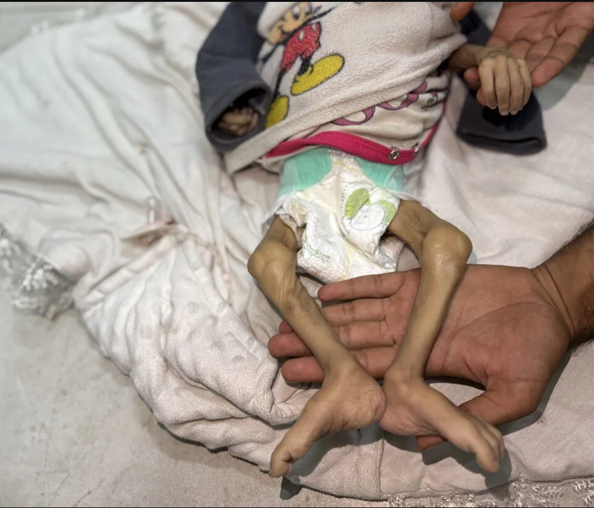 Cumhurbaşkanı Erdoğan'dan dünyaya tarihi çağrı: İşte o fotoğrafların hikayesi - Resim : 2