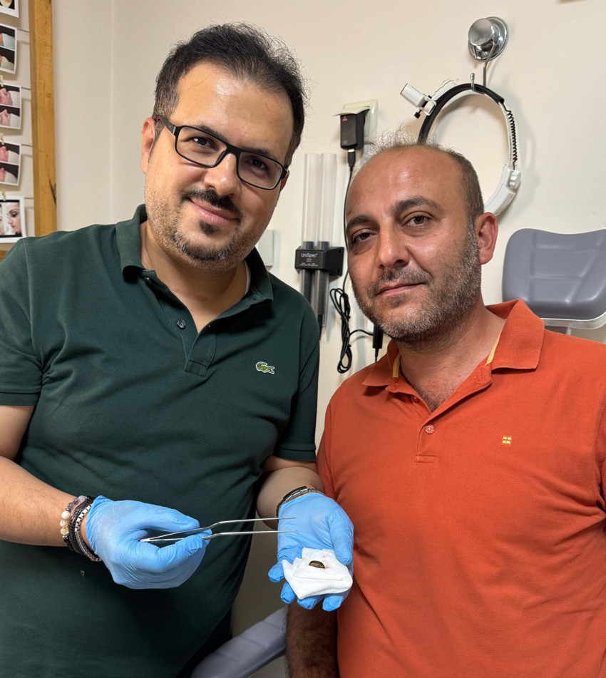 Ağrı ve işitme kaybı ile doktora gitmişti! Kulağından böcek çıktı - Resim : 2