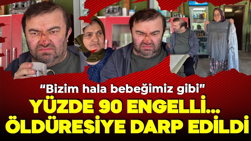 Bolu'da skandal olay! Yüzde 90 engelli vatandaş acımasızca darp edildi!