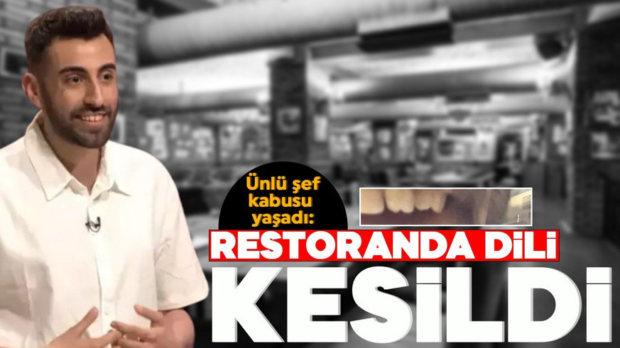 MasterChef Batuhan Ergül hayatının kabusunu yaşadı! Köfteden çıkan cam ünlü şefin dişini kırdı