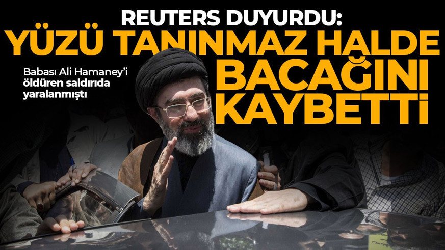 Mücteba Hamaney'in yüzü tanınmaz halde! Bacağını kaybetti iddiası