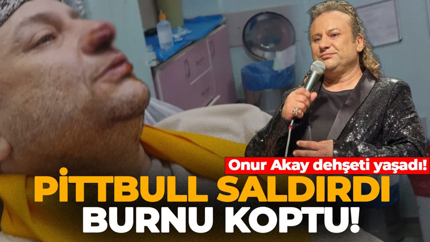 Onur Akay dehşeti yaşadı! Pitbull saldırısına uğradı, burnu koptu