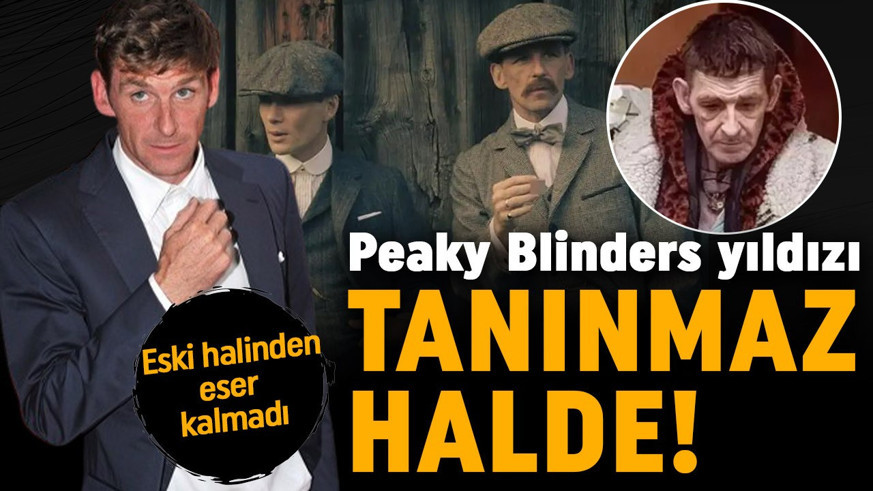 Peaky Blinders yıldızı tanınmaz halde! Eski halinden eser kalmadı