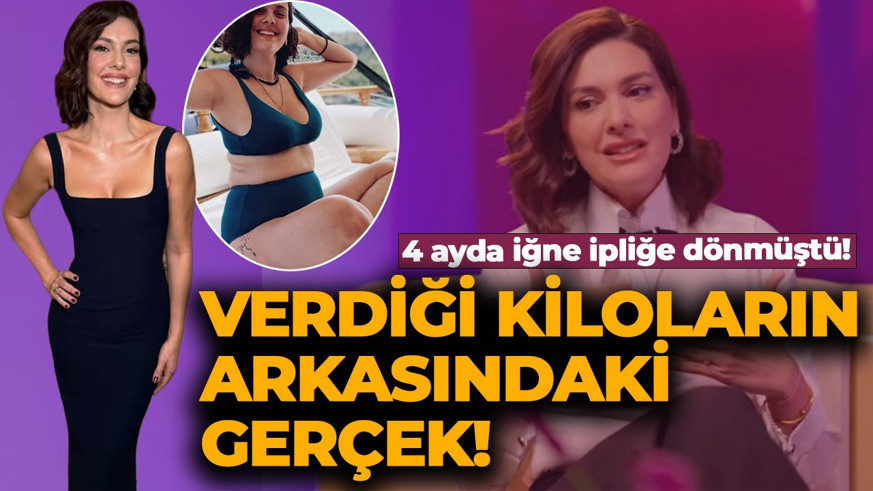 4 ayda iğne ipliğe dönmüştü! Bergüzar Korel'in verdiği kiloların arkasındaki gerçek ortaya çıktı