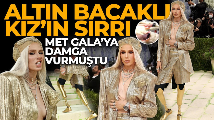 Kullandığı tampon yüzünden iki bacağı ampute oldu! "Altın Bacaklı Kız" Lauren Wasser'ın hikayesini öğrenenler şoke oldu