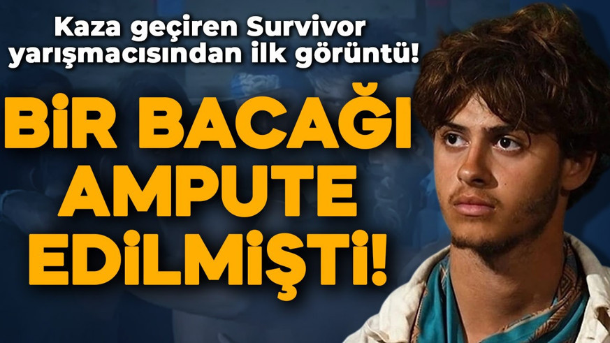 Bir bacağı ampute olmuştu! Survivor Yunanistan'da kaza geçiren Stavros Floros'tan ilk görüntü