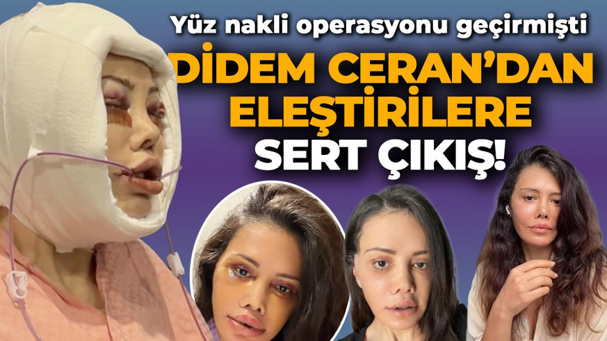 Yüz nakli operasyonu geçirmişti! Didem Ceran'dan eleştirilere sert çıkış