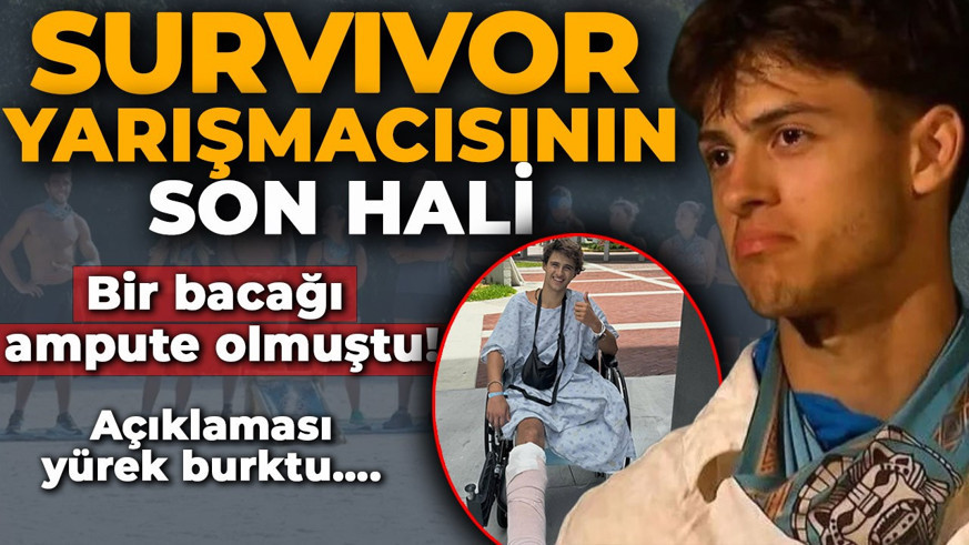 Bir bacağı ampute olmuştu! Survivor yarışmacısı Stavros Floros'un son hali ortaya çıktı