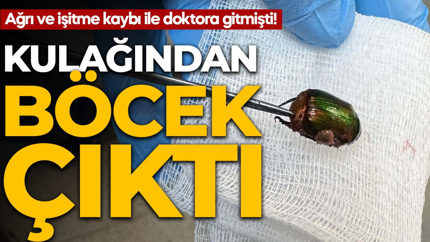 Ağrı ve işitme kaybı ile doktora gitmişti! Kulağından böcek çıktı