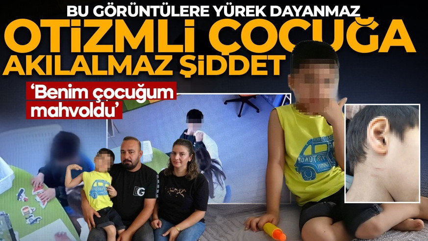 Bu görüntüler izleyenlerin yüreğini yaktı! Otizmli çocuğa eğitim merkezinde şiddet: Benim çocuğum mahvoldu