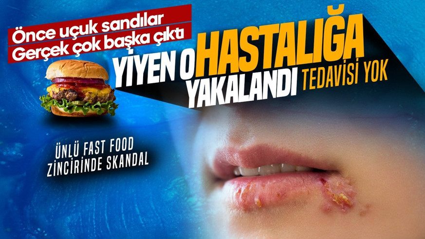 Fast food zincirinde skandal iddia! Yiyen tedavisi olmayan hastalığa yakalandı