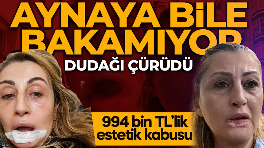 Estetik uğruna gitti, 7 yıldır mahkeme kapılarında: “Gülüşüm yok, yemek yemek problem”