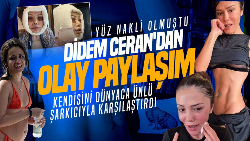 Yüz nakli olan Didem Ceran'dan olay paylaşım: Kendisini dünyaca ünlü şarkıcıyla karşılaştırdı