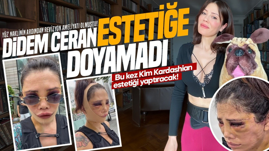 Yüz naklinin ardından revizyon ameliyatı olmuştu! Didem Ceran estetiği doyamadı: Bu kez Kim Kardashian estetiği yaptıracak!