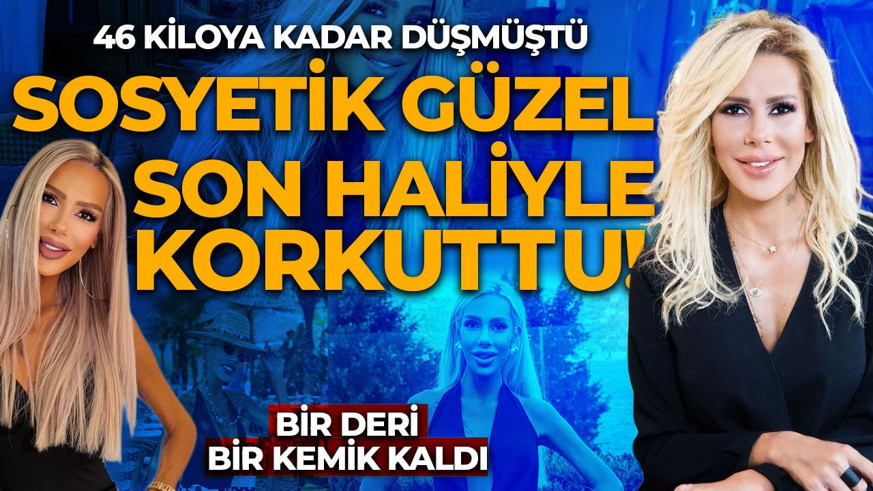46 kiloya kadar düşmüştü! Sosyetik güzel Hande Demir'in son hali korkuttu, bir deri bir kemik kaldı