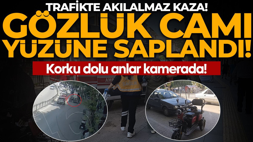Trafikte akılalmaz kaza! Gözlük camı yüzüne saplandı: O anlar kamerada