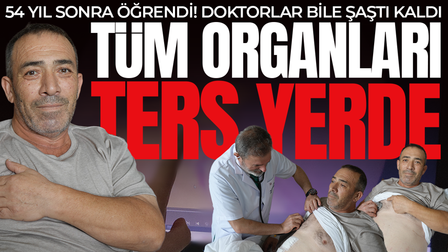 Tüm organları ters yerde: 54 yıl sonra öğrendi! Doktorlar bile şaştı kaldı