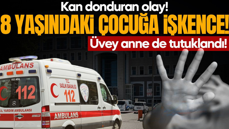 8 yaşındaki çocuğa ütüyle işkence! 3 kişi tutuklandı, aralarında üvey anne de var